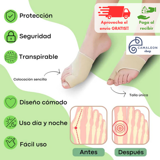 StepFree – Corrector de Juanetes con Gel Interno (1 par)