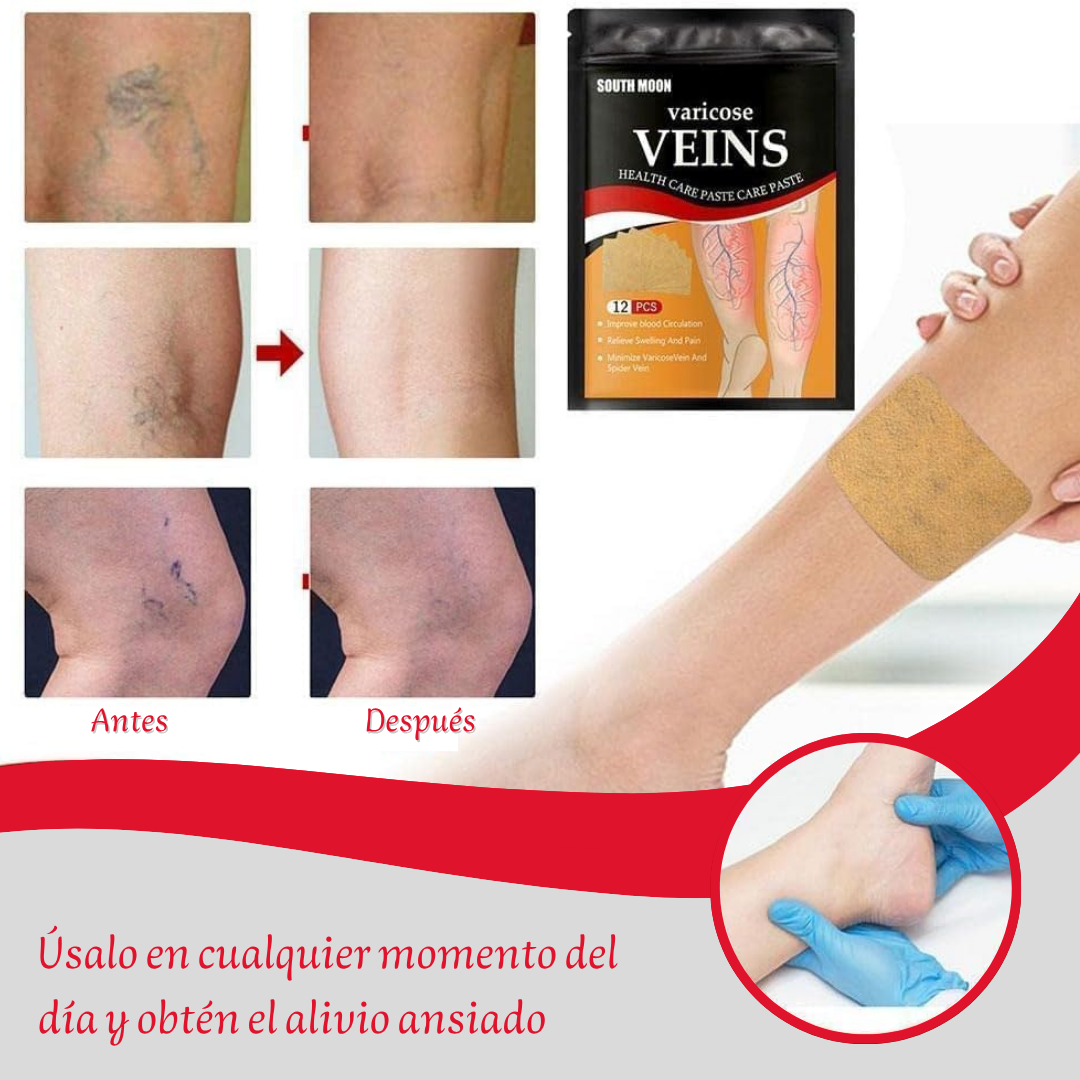 VarixRelief – Pack 12 Parches para Varices / Piernas Descansadas Desde la Primera Aplicación